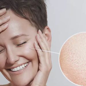 درمان تخصصی منافذ باز پوست