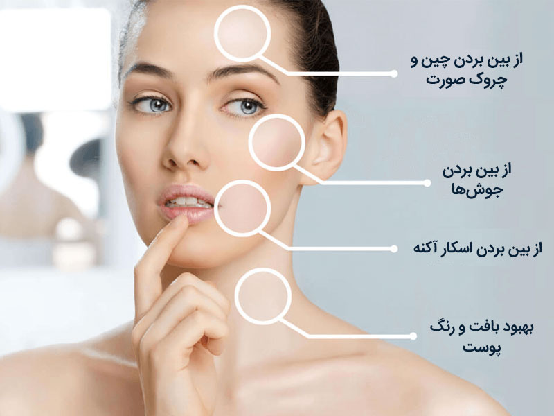 آموزش مراقبت از پوست اصفهان